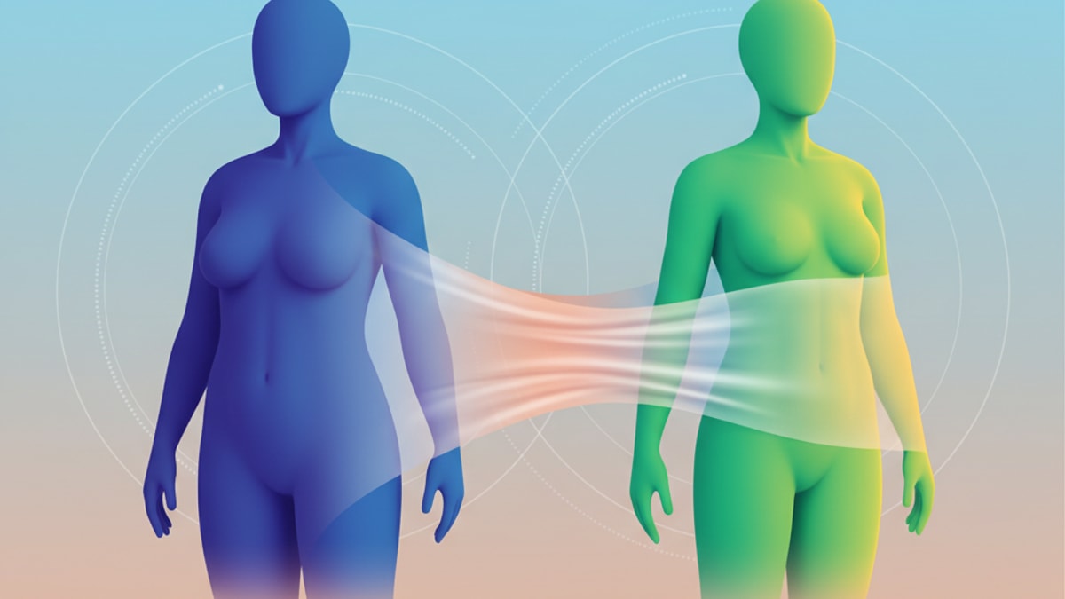 Does Skin Shrink After Weight Loss? An Expert Medical Breakdown