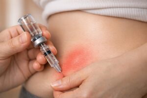 GLP-1 Injection Site Reactions: Causes and Fixes