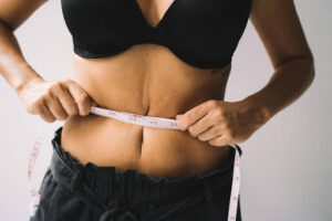 Medical Weight Loss in Florida: How to Access GLP-1 Treatment