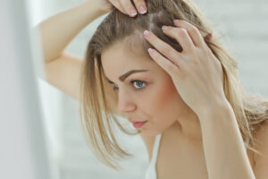 Hair Shedding Months Into Semaglutide